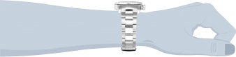 20932 wrist