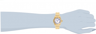 21075 wrist_1