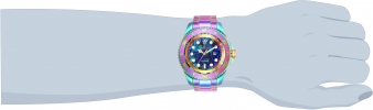 26658 wrist_1