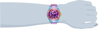 26659 wrist_1