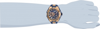 28863 wrist_2