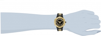 29522 wrist_1