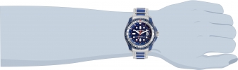29587 wrist_1
