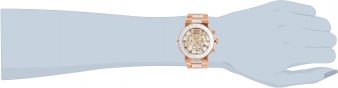 29668 wrist_1