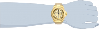 29730 wrist_1