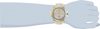 30207 wrist_1