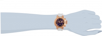 30434 wrist_1