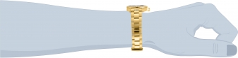 30695 wrist_1