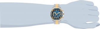 30757 wrist_1