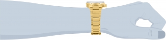 31515 wrist_1