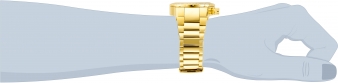 31587 wrist_1