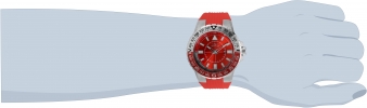 31924 wrist