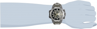 32982 wrist_1