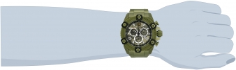 34098 wrist_1